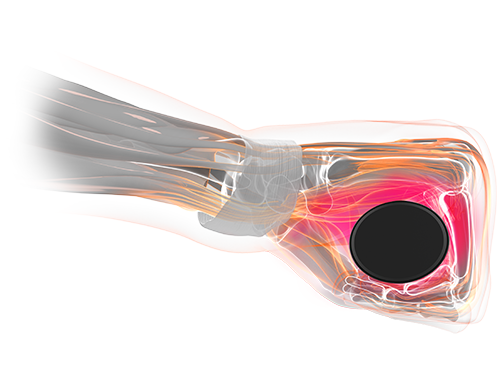sqlab.Bild_.hand_.griffform.falsch.500x380_2_wrong_grip_shape