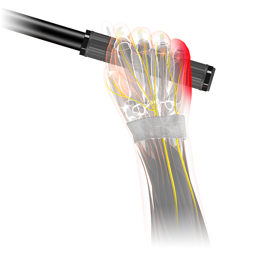 sqlab.PanelTeaser.griffpraesentation.kleiner.Finger.500x500_7_grip-702
